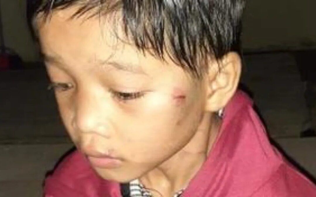 Lo golpeaban por travieso y lo abandonaron en la calle. Tiene 10 años.